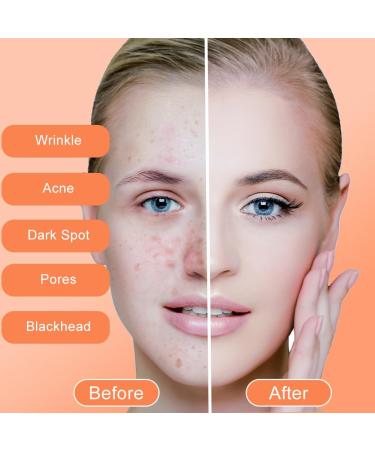  LOPHE Kojic Acid Soap 3 x 100g Kojic Acid Soap with Turmeric anti-dark spot soap for face and body moisturizing evens skin tone - Buy Online on GoSupps.com