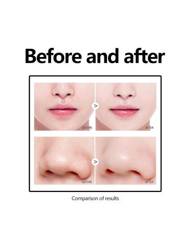 Blackhead Remover Mask - Peel Off Charcoal Face Mask for Deep Cleansing | Acne & Pore Control for Men & Women - Buy Online on GoSupps.com