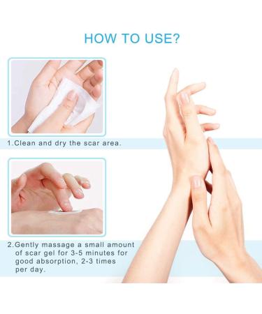 Kinbeau Silicone Scar Gel 30g - For Face, Body, C-Section, Stretch Marks, Surgical, Burn, Acne, Old & New Scars - White Blue - 1oz - Buy Online on GoSupps.com