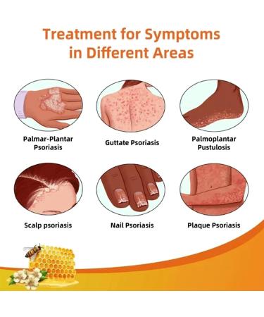Bee Venom Psoriasis Treatment Cream | Effective on All Skin Types - Buy Online on GoSupps.com