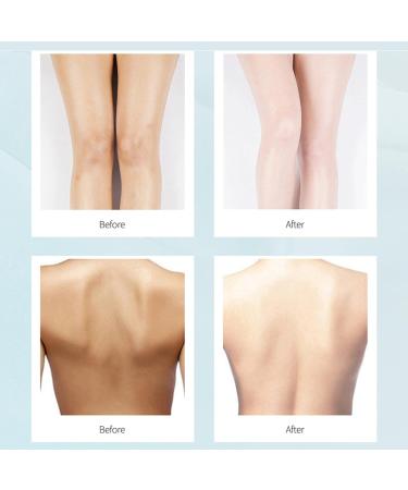  Eastuy Body Lightening Cream | Intimate Area Skin Lightening Cream | Gentle Moisturizing Lightener for Dark Spots on Underarms Chest and Lesbian - Buy Online on GoSupps.com