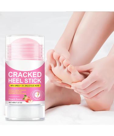 Lotion Pour Pieds Secs | Baume Nourrissant 40g Hydratant | Stick Adoucissant Peau - Soin Quotidien Nuit Voyage Salle De Bain Maison Personnelle Pour Talons Fissur s - Buy Online on GoSupps.com