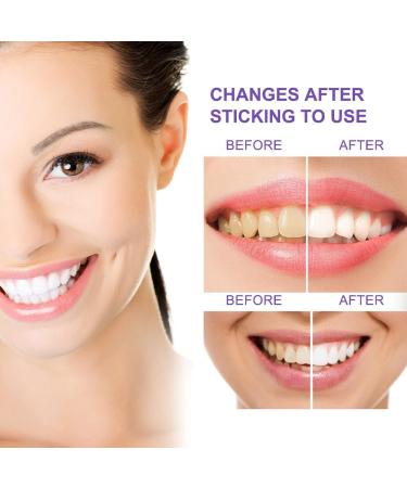 Whitening Toothpaste for Bright Teeth | Natural Stain Removal & Gum Repair - Buy Online on GoSupps.com