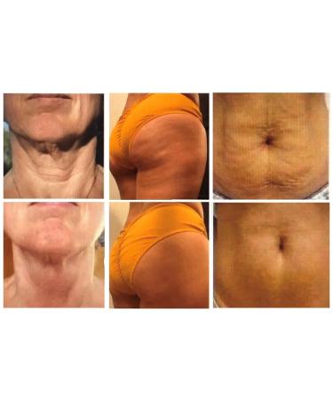 Body Firming & Cellulite Cream with Collagen (4 oz) - Visibly reduce the appearance of cellulite dimpled puckering skin and tighten loose areas by Healthy Life Creations - Buy Online on GoSupps.com