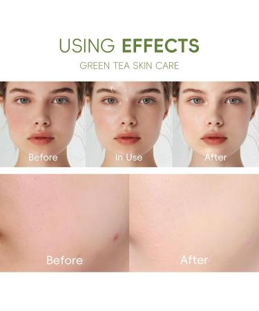 Green Tea Skin Care Set Soothes Skin Deep Cleanses Moisturizes & Controls Oil with Cleanser Toner Serum Eye Cream & Face Cream - Buy Online on GoSupps.com