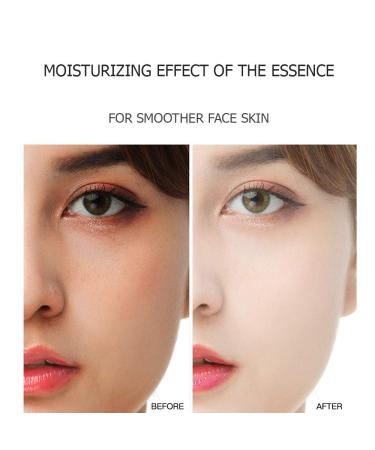 VENZEN Gold Protein Peptide Essence Serum for Combination Skin | 5x15ml | Deep Moisturizing & Skin Improvement - Buy Online on GoSupps.com