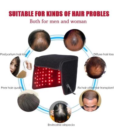  KUMIAO Hair growth cap anti-hair loss treatment device with controller promotes hair regrowth Adjustable brightness timer function 1 to 5 files - Buy Online on GoSupps.com