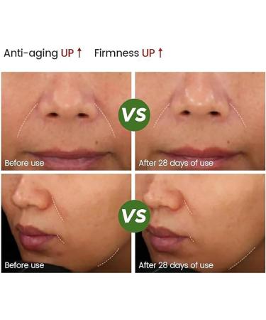  RFBKCSBDX Anti-Wrinkle Salmon Serum Moisturizing Nourishing Skin Firming Reducing Wrinkles Enhance Barrier Function for Face and Body for All Skin Types - Buy Online on GoSupps.com