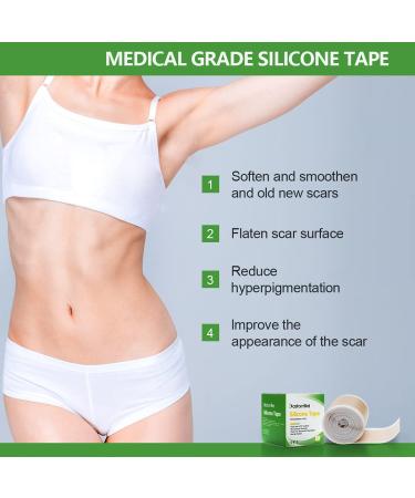 Silicone Tape for Scars - Soft Medical Tape for Keloid, Surgical, Burn, and Acne Scars - Tummy Tuck Post Surgery Supplies - 1.6 x 120 Roll - Buy Online on GoSupps.com