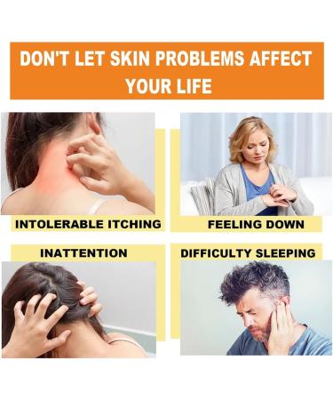 KCRPM Youth Bee Venom Psoriasis Treatment Cream - Soothing & Moisturizing Formula for All Skin Types | 1pcs - Buy Online on GoSupps.com