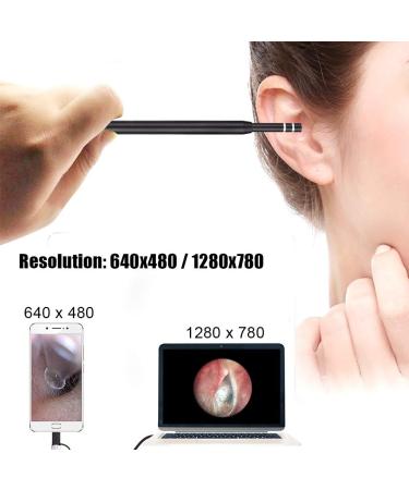 3-in-1 USB Earwax Removal Tool with HD Camera and LED Light - Ear Cleaner Endoscope for Adults, Kids, and Pets - Compatible with Android Smart Phones - Buy Online on GoSupps.com