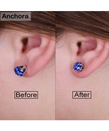 ANCHORA Original Magic Earring Backs - Earring Lifters for Heavy & Droopy Ears | Earlobe Secure Clear Miracle - BAX - Buy Online on GoSupps.com