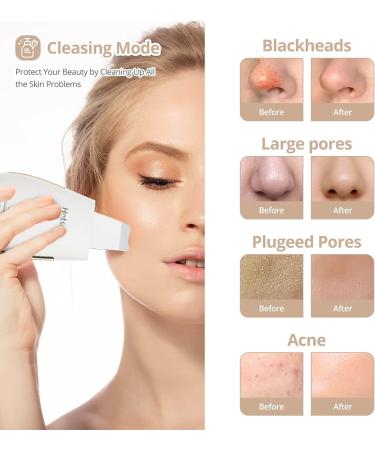 Hotsch Skin Scrubber Face Spatula - Ultrasonic Blackhead Remover and Pore Cleaner with 3 Modes - Rechargeable Facial Cleansing Tool - Buy Online on GoSupps.com