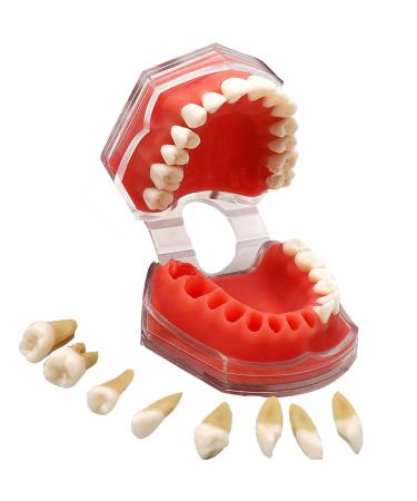 Bovdc tooth model soft gums full mouth removable dentistry model for dental merchant student assistant learning exercises tooth extraction resin material