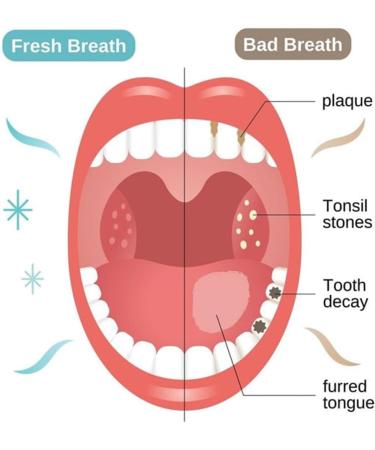 Intensive Whitening Toothpaste with Niacinamide Dazzle White Toothpaste with Nicotinamide Toothpaste for Sensitive Teeth Fresh Breath for Teeth - Buy Online on GoSupps.com