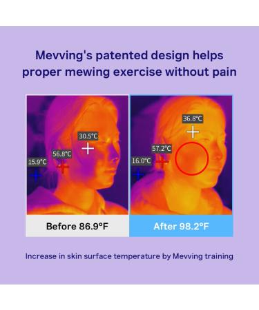 DAILYWONDER Mevving Tongue Trainer - Double Chin Reducer | V Line Lifting | Self Care Beauty Product - Buy Online on GoSupps.com