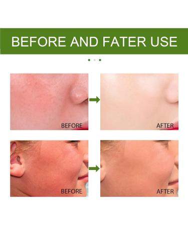 Aloe Vera Gel Pure Aloe Vera Gel For Face Aloe Vera Gel For After Sun Care And Skin Care Moisturizing Aloe Vera Cream 100% Natural Aloe Vera Gel Hydrating Aloe Vera Moisturiser - Buy Online on GoSupps.com