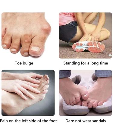 Keenso 2pcs Bunion Corrector & Toe Separators for Women - Universal Female Toe Splints for Overlapping Big Toe - Buy Online on GoSupps.com