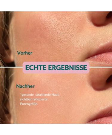 Washing Gel for Facial Cleaning with Salicylic Acid & Bio Aloe Vera | Natural Anti-Pimple Cleaner | 150ml Facial Care by Mother Nature - Buy Online on GoSupps.com