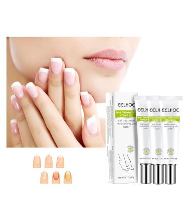 Yueci Hand and Foot Care Cream | Heal Damaged Nails & Cracked Skin | Nail Repair Treatment for Renewed Beauty - Buy Online on GoSupps.com