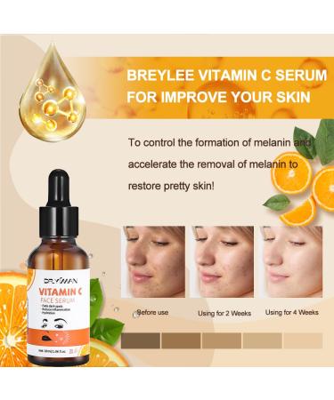Buy Vitamin C Serum for Face - Brightening Anti-Aging Acne & Dark Spot Treatment | 30ml Moisture Facial Serum - Buy Online on GoSupps.com