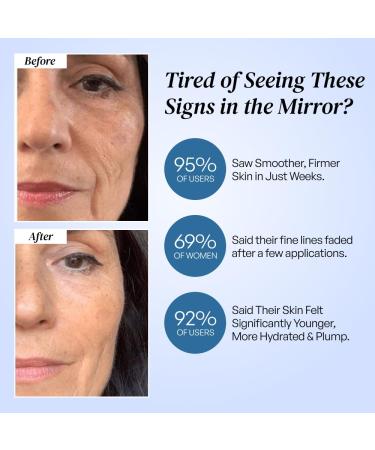 Elir Korean Anti-Aging Face Cream with Vitamin C and Aloe Firming Hydrating and Wrinkle Repair Moisturizer Sensitive Skin Dermatologist-Approved 30ml - Buy Online on GoSupps.com