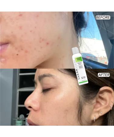 Clearstem VitaminScrub | Antioxidant Infused Exfoliating Scrub with Vitamin C | 7 oz | Face & Body Scrub - Buy Online on GoSupps.com