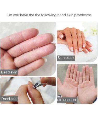 Hand Peel Mask 5Pcs Lavender Moisturizing Gloves Hand Mask Moisturizing Repair Skin for Dry Rough Hands - Perfect Daily Hand Care Treatment Get Soft Smooth Hands - Buy Online on GoSupps.com