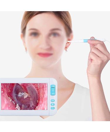 HSRG Portable Digital Otoscope - HD 1080p Ear Cleaner with 3.9mm Lens 4.3 IPS Screen & 6 LED Lights | Ideal for Adults Kids & Pets - Shop Internationally! - Buy Online on GoSupps.com