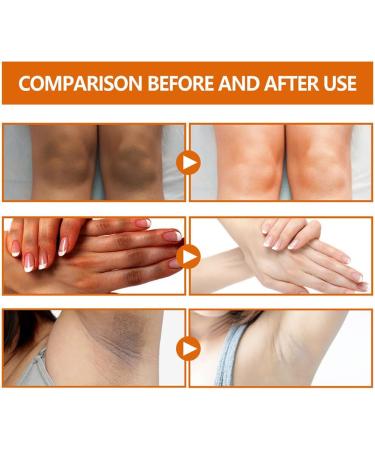 lmoikesz Women Skin Repair Serum Portable Elbow Knee Nourishing Moisturizing Essence Anti-wrinkle Skincare Beauty Supplies - Buy Online on GoSupps.com
