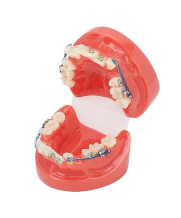 Buy GFRGFH Dental Model with 24 Teeth - Half Metal Half Ceramic Bracket for Teaching & Study - International Shipping Available - Buy Online on GoSupps.com