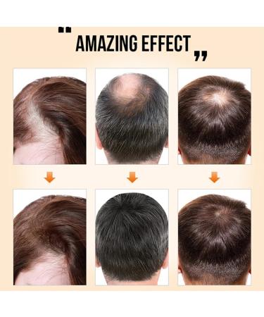 AUklOPVZZ Ginger Hair Growth Products Prevent Hair-Loss Regrowth Essential Oil Professional Smoothing Nutrient Solution for Men - Buy Online on GoSupps.com