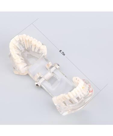 Buy Dental Diseases Teaching Study Adult Typodont Model - Realistic Tooth Demonstration for Education | International Shipping Available - Buy Online on GoSupps.com
