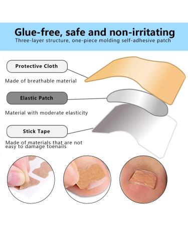 50PCS Ingrown Toenail Correction Patch with 4PCS Nail Tool - Glue-Free Ingrown Toenail Sticker for Foot Care Treatment - Buy Online on GoSupps.com