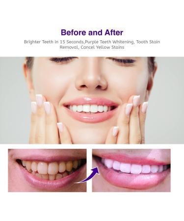 Purple Teeth Whitening Foam - Stain Removal & Whitening Booster (50ml) - Buy Online on GoSupps.com