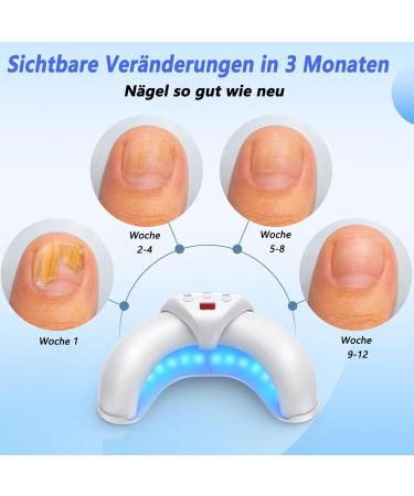 Shop Halae's Light Therapy Device for Nail Fungus - Effective Cold Laser Treatment & Nail Care Solution - Buy Online on GoSupps.com