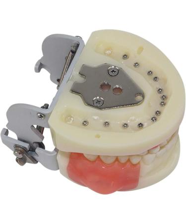 Life-Size Human Teeth & Abscess Model - Perfect for Student Teaching & Practice - Buy Online on GoSupps.com