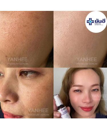 Yanhee Premium Serum Extract & Mela Cream Tranexamic Acid Set | Superior Skincare for Radiant Skin - International Shipping Available - Buy Online on GoSupps.com