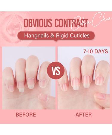 CHUCHU Huile pour cuticules pour ongles huile de jojoba pour cuticules contient de la vitamine B et E hydrate la peau des cuticules et des ongles pr vient les ongles et les gerces 15 ml (rose) - Buy Online on GoSupps.com