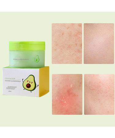 Baume de Nettoyage du Visage Nettoyant Fondant pour le Visage Baume D maquillant Visages Baumes D maquillant Baumes Nettoyant Hydratant Bauma D maquillants et Nettoyants pour le Visages 100g style-1 - Buy Online on GoSupps.com