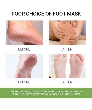 3 Pairs Foot Peel Mask Socks - Hydrating Foot Spa Treatment for Dry & Cracked Feet - Cornea Removal & Moisturizing Effects for Men & Women - Buy Online on GoSupps.com