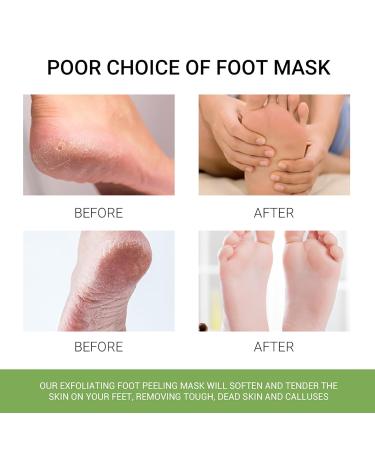 3 Pairs Aloe Vera Foot Mask Peeling Socks - Smooth Baby Soft Feet Corns & Dead Skin Remover for Men & Women - Buy Online on GoSupps.com