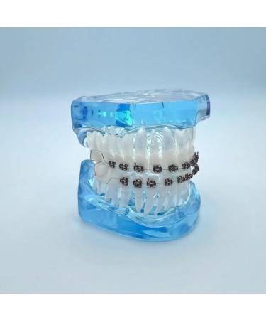 1 Pair of Temporary Tooth Decoration Teeth Retainer Practical Brackets para Dientes Sturdy Retenedores de Dientes Ortodoncia Props for Dental Students to Practice (Black) - Buy Online on GoSupps.com