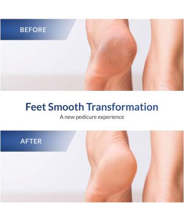 COMGO Metal Pedicure Foot File Callus Remover - Double-Sided Scrubber for Dead Skin - Professional Quality (1 Piece, Black) - Buy Online on GoSupps.com