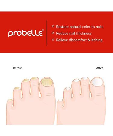 Probelle Natural Fungal Cleansing Wash - Maximum Strength, Fragrance-Free 9.5 fl oz - Buy Online on GoSupps.com