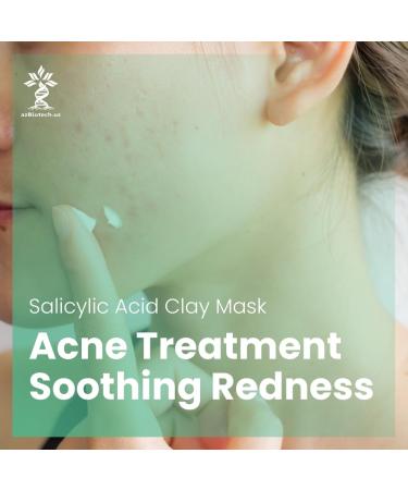 Salicylic Acid Facial Clay Mask for Acne with Vitamin C & Aloe Vera - Deep Pore Cleansing 4.23 OZ | International Shipping Available - Buy Online on GoSupps.com