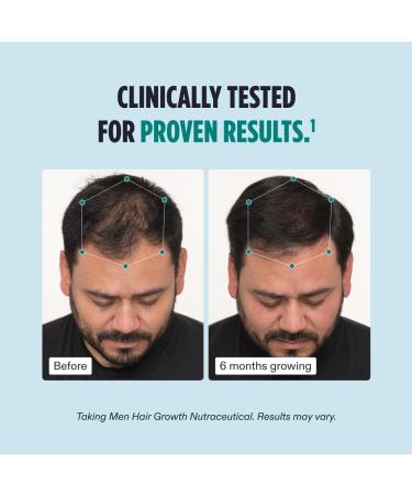 Men's Hair Growth Supplement | Clinically Tested Doctor Recommended 1 Month Supply for Thicker Hair & Scalp Coverage - International Shipping Available - Buy Online on GoSupps.com