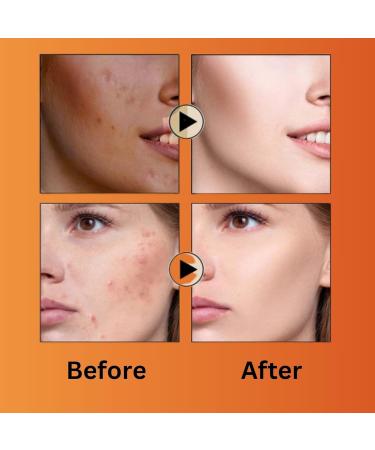 Miracle Beauty Papaya Daily Routine Womens Face Wash travel size & Cleanser By Bangkok Technology | Face Wash Scrub | No Side-effect Free - Buy Online on GoSupps.com