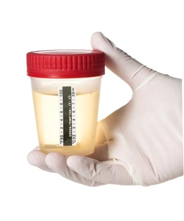 Urine Temp Strips 25pcs | Fish Tank Test Strips | Urinalysis Sticker - Buy Online on GoSupps.com