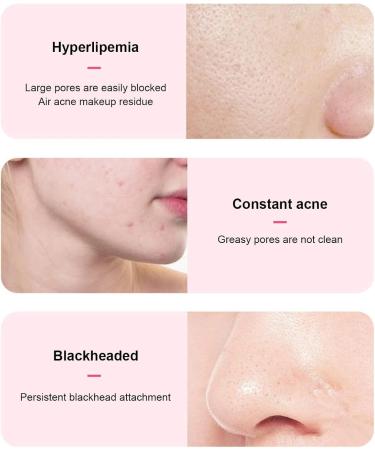 Zuasdvnk Facial Scrubber | Penguin Shape Electric Facial Cleansing Brush Waterproof Skin Care Face Brushes Electric Face Brush for Women and Men Pink - Buy Online on GoSupps.com